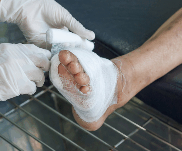 Diabetic Ulcer Los Angeles